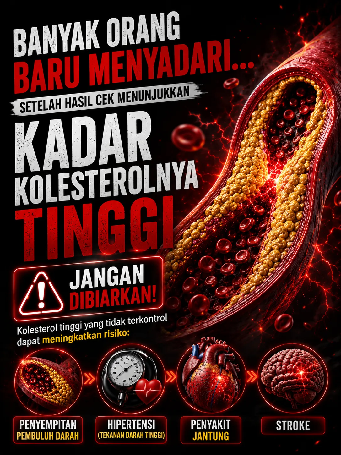 Banyak orang baru menyadari kolesterolnya tinggi — jangan dibiarkan: penyempitan pembuluh darah, hipertensi, jantung, stroke
